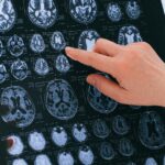 A medical professional examines a brain MRI scan, focusing on neurological health.
